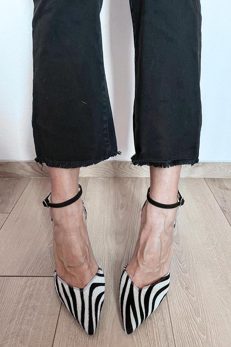 ZEBRA-PRINT PUMPS WITH ANKLE STRAP